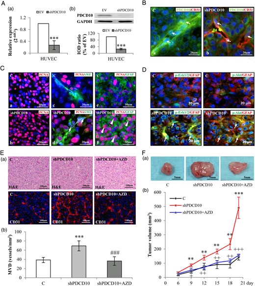 Endothelial knockdown of PDCD10 stimulated neo-angiogenesis and tumor growth in a human glioblastoma (GBM) xenograft model in mice. The xenograft tumors were resulted from the mixtures of U87 and EV-transduced human umbilical vein endothelial cells (HUVECs) (C) or U87 and shPDCD10-HUVECs (shPDCD10). shPDCD10 mice (shPDCD10+AZD) were treated with AZD2171 (3 mg/kg, i.g.) beginning on the sixth day of implantation for 14days (n = 4); C and shPDCD10 mice received vehicle only (n = 4 for each group). The xenograft tumors were removed from the mice after 20 days of implantation. (A) Confirmation of PDCD10 knockdown at mRNA (a) and protein levels (b) in HUVECs before mice implantation. *** P < .001, compare to EV. (B) Stable knockdown of endothelial PDCD10 in xenograft tumors. Double-staining indicated absence of PDCD10 in CD31-positive cells (red) in tumors formed by U87 and shPDCD10-HUVECs (shPDCD10-mice) (arrows in b), whereas co-expression of PDCD10 (green) and CD31 (red) was detected in ECs of tumors formed by U87 and EV-HUVECs (C) (arrows in a). Scale bar: 20 µm. (C) Endothelial knockdown of PDCD10 facilitated tumor cell proliferation. Immunofluorescent staining indicated extensive PCNA immunoreactivity (red) in shPDCD10-mice (b) compared with the control (a). Double staining showed that ECs (arrows in d) and GFAP-positive tumor cells (arrowheads in f) were undergoing a more massive proliferation in shPDCD10-mice as compared with the controls (c and e). Scale bar: 50 µm in a, c, d and f; 20 µm in b and e. (D) Endothelial deletion of PDCD10 activated Erk1/2 and Akt in xenograft tumor cells. Double-staining demonstrated the activation of Erk1/2 (green) or Akt (green) in GFAP-positive GBM cells (red) of xenograft tumors from shPDCD10-mice (arrows). Scale bar: 20 µm. (E) Endothelial knockdown of PDCD10 stimulated neo-angiogenesis, which was reversed by the treatment of mice with AZD. Both H&E staining and CD31-immunofluorescent staining (a) revealed increased microvessel density (MVD) with more branches in xenograft tumors of shPDCD10-mice compared with control. The neo-angiogenic features induced by shPDCD10 were reversed by AZD treatment. Quantitative analysis of MVD is shown in b. *** P < .001, compare to C; ### P < .001, compare to shPDCD10. Scale bar: 100 µm. (F) Co-implantation of U87 and shPDCD10-HUVECs promoted tumor growth that was abolished by the treatment of mice with AZD. The representative photos show the tumors from control-, shPDCD10-mice, and AZD-treated shPDCD10-mice on day 20 after implantation (a). Scale bar: 5 mm. The tumor growth curve is shown in b. ** P < .01 and *** P < .001, compare to C; + P < .05, ++ P < .01 and +++ P < .001, compare to shPDCD10.