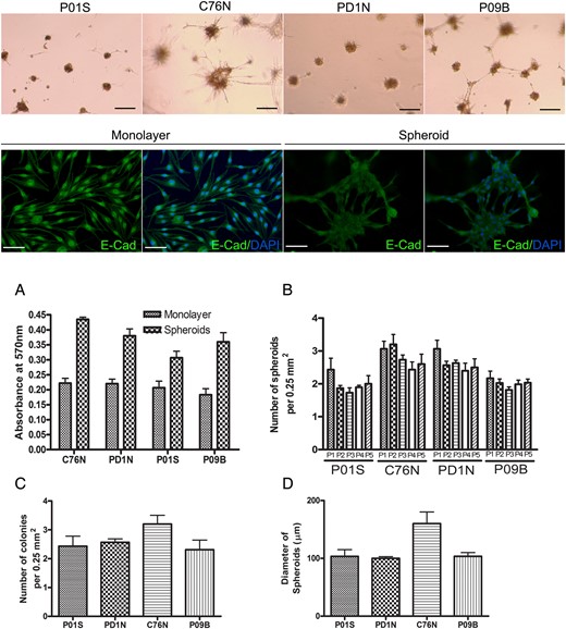 Anchorage-independent growth of patient-specific tumor cells as tumor spheroids. Upper row panel shows bright field pictures of nevus cells (containing brown melanin pigment) growing as spheroids when seeded on Geltrex growth factor–free basement membrane matrix (scale bar = 100 μm). Second row, immunofluorescence for E-cadherin (green) in monolayer cells (left panel) showing a nuclear localization vs spheroids (right panel) showing a more cytosolic and membrane localization in C76N cells. Nuclei were counterstained with DAPI (4′,6-diamidino-2-phenylindole) in blue (scale bar = 100 μm). Graphs show: (A) nevus cells grown as spheroids had higher cell proliferation rate (as measured by MTT cell proliferation assay) compared with monolayer (P < .001 for all cell lines). (B) Change of clonogenicity over passages. The number of spheroids formed after each passage from each cell is similar up to 5 passages (P > .05 for all cell lines). (C) The number of colonies formed from each cell line after seeding ∼50 000 cells per well in a 24-well plate is similar (P = .085). Colonies were counted after staining with crystal violet and averaged per 0.25 mm2. (D) Average size of the spheroids (y-axis represents diameter in μm) formed from each patient sample after 96 h of growth on Geltrex matrix. C76N shows bigger spheroids compared with the other cell lines (P = .017).