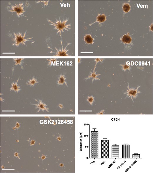 C76N-derived nevospheroids treated with vemurafenib (Vem), MEK162, GDC0941, and GSK2126458 as compared with vehicle (Veh)-treated control. Vehicle-treated spheroids show compact colonies with peripheral dendritic cells radiating outwardly. Spheroid size decreased mildly with 5 µM vemurafenib treatment, which also induced loss of dendritic cells at the periphery. Five-micromolar MEK162 and GDC0941 induced a modest nevosphere size reduction, with very little change in spheroid morphology. GSK2126458 treatment induced significant spheroid size reduction at a relatively lower concentration (0.5 μM) in comparison with the other drugs. Bar represents 100 µm.