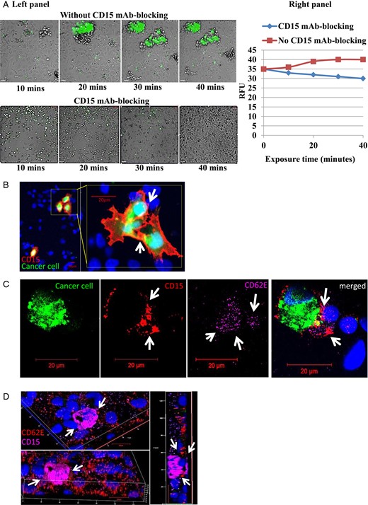 CD15 mAb-blocking reduces adhesion of non–small cell lung cancer (NSCLC) cells under dynamic conditions. (A, left panel) A dynamic cell adhesion assay was carried out on highly metastatic brain cells (SEBTA-001) using an AxioVert 200 M microscope (C. Zeiss) within an environmentally controlled incubator. SEBTA-001 cells were incubated with isotype control (IgM) or CD15 mAb followed by perfusion of 1 × 106 cells over a monolayer of hCMEC/D3 cells at 2.5 dyn/cm2 for 40 minutes. Phase contrast and fluorescent images were acquired at real time every 10 minutes with an X5 objective using Volocity software. Scale bar = 20 μm. (A, right panel) Representation of A, left panel in relative fluorescent units of SEBTA-001 cell adhesion with and without CD15 mAb for 10, 20, 30, and 40 minute time points. (B–D) Confocal images of green fluorescently labeled adherent brain to lung metastatic cancer (SEBT-001) cells cultured on a monolayer of hCMEC/D3 cells (blue). (B) CD15 expression (red) on the edges of SEBT-001 (green). ICC images showed expression of CD15 (red) on the adherent cancer cells (green) on a monolayer of human brain endothelial cells stained with Hoechst blue C: The merged image shows expression of CD15 (red) on adherent tumor cells (SEBTA-001) (green) on an activated monolayer of human brain endothelial cells (blue) expressing CD62E (purple). (D) Optical sections of 3-dimensional confocal image created from z-stack. The top and lower views represent one image at different angles through the z-stack, showing an adherent SEBTA-001 expressing CD15 (purple) on an activated monolayer of brain endothelial cells expressing CD62E (red). Right-side view represents an optical section through the depicted z-stack showing the precise interaction between CD15 and CD62E during NSCLC-brain endothelium cell adhesion.