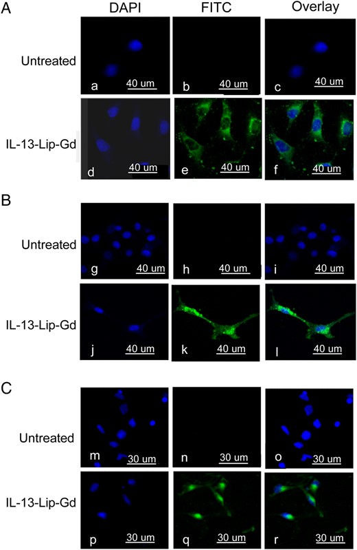 Confocal microscopy images for IL-13-Lip-Gd-DTPA uptake in cell culture, (A) U251, (B) U87, and (C) T3691, respectively. Blue color indicates the nucleus stained with DAPI, and green color indicates FITC-labeled liposomes. The overlay for the 2 images in the left column shows the internalization of the FITC-labeled IL-13-Lip-Gd-DTPA in glioma tumor cell lines.