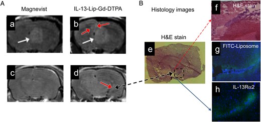 (A) T1-weighted MRI of glioma enhanced with Magnevist (a, c) and IL-13-Lip-Gd-DTPA (b, d) from the same animal. The images of the same brain slice (a, b) show the primary tumor (white arrows). Additionally enhanced focal areas (red arrows) peripheral to the primary site are shown only with IL-13-Lip-Gd-DTPA. The images (c, d) were acquired from a brain slice 2 mm posterior to the primary site and show additional tumor masses (red arrow) only with liposomes. (B) Image (B-e) of histology slice within the same brain slice in MR image in A-d. Image (B-f) is zoomed into an infiltrating brain tumor (blue color) in the dashed line box in the hematoxylin and eosin (H&E) stain. The corresponding microscopy image (B-g) shows FITC-labeled liposomes (green color) focal in the tumor area. Image (B-h) shows a confocal image of immunohistochemistry overlaid with DAPI obtained from a brain slide 300 μm from the H&E image (B-e). The differential expression of IL-13Rα2 in the glioma and adjacent normal tissues is clearly demonstrated.