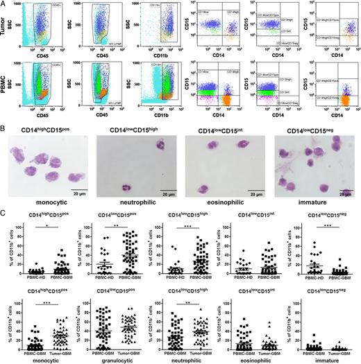 Distribution of different myeloid-derived suppressor cell (MDSC) subsets in peripheral blood and tumor tissue of participants with primary glioblastoma (GBM) (A) Representative dot plots are shown to illustrate the gating strategy for the discrimination of different MDSC subsets. After removal of trash, aggregates, and dead cells by forward/side scatter gating, lymphocytes were excluded from CD45+ leukocytes, and cells with high expression of the myeloid marker CD11b were selected to exclude resident microglia or tumor-infiltrating macrophages that usually exhibit a CD11blow expression profile. Cells were then separated into a CD14high and CD14low fraction. Based on the expression of CD15, CD14low cells were further divided into CD15high, CD15int, or CD15neg cells. Similarly, CD14high cells were split into CD15pos and CD15neg cells. (B) Morphologic characteristics of different MDSC subsets in the peripheral blood of GBM participants. PBMCs were stained with CD45, CD11b, CD14, and CD15, and MDSC subsets were sorted by flow cytometry as depicted in (A). Cytospins and H&E staining were conducted. Representative pictures of different MDSC subsets are shown in (B). CD14highCD15pos cells displayed typical features of monocytes with a lobulated or reniform nucleus (usually eccentrically placed) and a grayish-blue cytoplasm. CD14lowCD15high cells revealed the typical morphology of neutrophils with segmented nuclei and pale pink cytoplasm. CD14lowCD15int cells displayed features of eosinophils with a classic bilobed nucleus and eosinophilic cytoplasm filled by numerous red granules of uniform size. CD14lowCD15neg showed big round nuclei with a small basophilic cytoplasm characteristic for immature myeloid cells. (C) Frequencies of different MDSC subsets within PBMCs and tumor cell suspension of healthy donors (PBMC-HD; n = 26) and GBM participants (PBMC-GBM, Tumor-GBM; n = 52). P values were calculated using the 2-tailed Mann-Whitney test. For detailed statistics, see Supplementary material, Table S1.