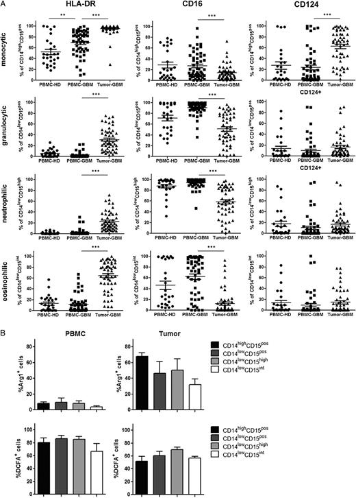 Further phenotypic characterization of different myeloid-derived suppressor cell (MDSC) subsets in peripheral blood and tumor tissue of participants with primary glioblastoma (GBM). (A) The expression of HLA-DR, CD16, and CD124 on different MDSC subsets was evaluated by flow cytometry. The frequencies of HLA-DR, CD16, and CD124-positive MDSCs within peripheral blood mononuclear cells (PBMCs) and tumor cell suspensions of healthy donors (n = 26) and GBM participants (n = 52) are shown. Asterisks denote significant P values: * P < .05; ** P < .01; *** P < .0001. (B) Arginase I and reactive oxygen species (ROS) production by different MDSC subsets were determined by flow cytometry. The frequencies of arginase I and ROS-positive MDSCs from 5 GBM participants are presented.
