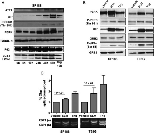 SLM induces a potent and maintained UPR in glioma cells. (A) Time-dependent kinetics of the SLM-induced UPR response. SF188 cells were incubated with SLM (0.1 μM) and collected at the indicated times. Cells treated with Thg for 10 h were used as an ER stress positive control. Samples were analyzed by western blot for activating transcription factor 4 (ATF4), BIP, pPERK and PERK, p62, and LC3 lipidation. α-Tubulin was used as loading control. (B) SLM and Thg induce the UPR response in glioblastoma cell lines. SF188 or T98G cells were incubated with either SLM (0.1 μM) or Thg (0.1 μM) and collected at 48 h or 4 h, respectively. Samples were analyzed by western blotting for PERK, pPERK, BIP, and phospho-eIF2a. GRB2 was used as the loading control. (C) SF188 or T98G cells were incubated with either SLM (0.1 μM) or Thg (0.1 μM) and collected at 48 h. XBP1 splicing was assessed with conventional PCR. XBP1u (unspliced, 488 bp) and XBP1s (spliced, 418 bp). Shown are representative western blots of 3 independent experiments.