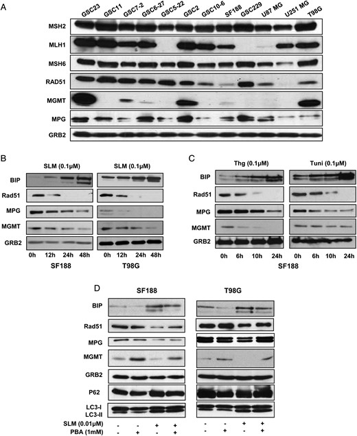 ER stress downmodulates the DNA repair proteins MGMT, MPG, and Rad51 in glioma cells. (A) The indicated glioma cell lines were collected and MSH2, MLH1, MSH6, Rad51, MGMT, and MPG protein levels were evaluated by western blot. (B) SF188 and T98G cells were incubated with SLM (0.1 μM). Samples were collected at the indicated times, and MPG, MGMT, Rad51, and BIP expression levels were analyzed by western blotting. (C) Treatment of glioma cells with ER stress-inducing drugs results in the downregulation of MGMT, MPG, and Rad51. SF188 or T98G cells were incubated with the ER stress inducers Thg or tunicamycin (Tuni) at the indicated concentrations. The levels of MPG, MGMT, Rad51, and BIP expression were analyzed by western blotting. (D) Treatment of glioma cells with PBA rescues the MGMT and MPG protein levels. SF188 or T98G cells were incubated with SLM, PBA, or both agents. The levels of MPG, MGMT, Rad51, and BIP expression were analyzed by western blotting. In all the panels we used, GRB2 was the loading control. Shown are representative western blots of 3 independent experiments.