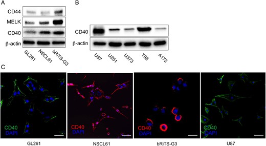 Expression of CD40 in mouse and human glioma cell lines. (A) CD40 expression was found in all mouse glioma cell lines. NSCL61 and bRiTs-G3 cells showed relatively higher levels of CD40 expression than GL261 cells. Glioma stem cell markers, MELK, and CD44 were also expressed in these cells. (B) CD40 expression was also found in human glioma cell lines. (C) Cells were examined by immunocytochemistry for CD40 (B: green; C, D: red). Nuclei were counterstained with DAPI (blue). CD40 expression was found at cell membranes. Scale bars, 20 µm.