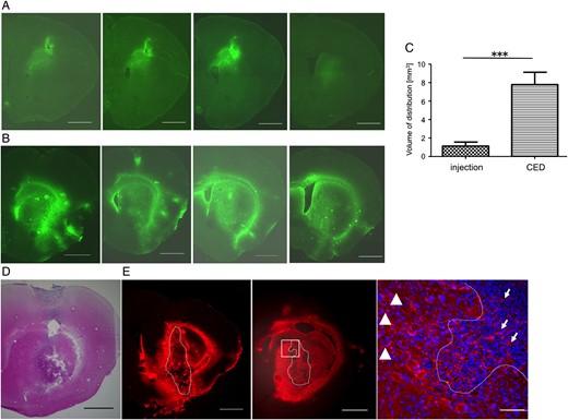 Distribution of FGK45 in mouse brain parenchyma (A, B, and C) and in mouse brain tumor model (D and E). After direct injection (A) or convection-enhanced delivery (CED) (B) of FGK45, fluorescent staining for FGK45 (green) detected the distribution of FGK45 in mouse brain parenchyma. Sequential sections from representative mouse brain are shown. The mean Vd of CED (n = 5, 7.788 ± 0.4316 mm3) was significantly robust compared with that of direct injection (n = 5, 1.126 ± 1.126 mm3) (C). Bars indicate mean ± SE. Student t test ***P < .0001. In bRiTs-G3 model 5 days after tumor cell implantation (D, H&E stain), extensive and diffuse distribution of FGK45 (red) after CED were detected in tumor bed as well as in surrounding brain parenchyma (E, left and middle; sequential slices with 100 µm interval). Enlarged image of the white rectangular box in middle panel (E, right). Dotted lines indicate tumor margin. Scale bars in A, B, D, and E (left and middle) indicate 1000 µm, and in E (right) indicate 100 µm. Arrows indicate FGK45 distribution inside the tumor, and arrowhead depicts that in surrounding brain parenchyma.