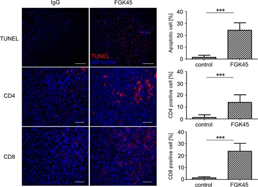 Antitumor efficacy of local delivery of FGK45 in the bRiTs-G3 model. The mechanism underlying antitumor efficacy of local delivery of FGK45 was evaluated in the bRiTs-G3 model. Two days after treatment, TUNEL staining revealed an increased number of apoptotic cells in the FGK45-treated group. TUNEL (red) staining in the bRiTs-G3 model, counterstained with DAPI (blue). Scale bars, 100 µm. The number of cells was counted under ×400 magnification. Bars indicate mean ± SD (***P < .05). Immunohistochemistry for mouse CD4 and CD8-positive T cells (red) in the bRiTs-G3 model was performed using brains harvested 7 days after treatment. Nuclei were counterstained with DAPI (blue). The number of cells positively stained for CD4 or CD8 was counted under ×400 magnification. Bars indicate mean ± SD (***P < .05). Scale bars, 50 µm.