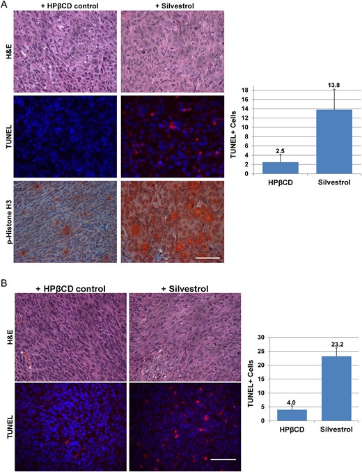 Silvestrol-treated tumors exhibit decreased cellularity and increased apoptosis. (A) ST8814-Luc tumors treated with silvestrol for 4 weeks exhibited reduced cellularity (top) and increased TUNEL labeling (middle) and phospho-histone H3 staining (bottom) compared to HPβCD-treated controls. (B) Sch10545-Luc schwannomas treated with silvestrol for 3 weeks had reduced cellularity (top) and increased TUNEL labeling (bottom). Representative images are shown, and TUNEL-positive cells were counted from 2 or more fields with means and SDs calculated. Scale bar is 200 µm.