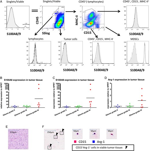 S100A8/9 and arginase expression in tumor tissue. (A) Tumor tissue single cell suspensions were stained as described and analyzed using flow cytometry. Single, viable cells were plotted for S100A8/9 (top left panel) and subsequently plotted for CD45 expression against the sideward scatter (SS; top second panel). CD45+ cells excluding lymphocytes were plotted for CD15 and MHC-II (top third panel). Lymphocytes (CD45+SSlow) (bottom left panel), tumor cells (CD45−) (bottom second panel), CD45+MHC-II+ (top right panel), CD45+MHC-II−CD15− (bottom third panel) and PMN-MDSCs (CD45+CD15+MHC-II−) (bottom right panel) were plotted for S100A8/9 expression. A representative plot from 6 donors measured is displayed. (B–D) S100A8 (B), S100A9 (C) and arginase (D) expression of tumor tissue single cell suspension was measured by qPCR with Ct values plotted relative to HPRT in a scattered plot. Grade II (n = 4; blue triangles), grade III (n = 6; green triangles) or grade IV gliomas (n = 7; red dots) were grouped. (E&F) H&E staining (E) or IHC double staining (F) with CD15 (pink) and arginase (blue) (original magnification x50) of glioma histological sections. Arrows highlight some CD15+arginase+ cells. Three frames from the IHC double staining are further enlarged (x400).