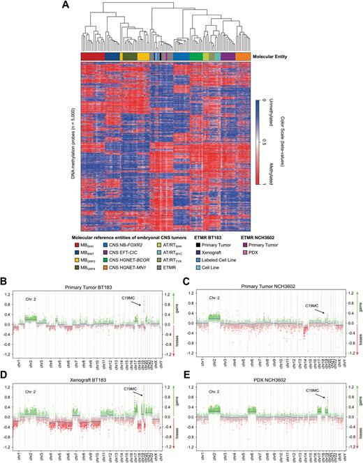 Methylation profiles of the ETMR xenograft model BT183 and the NCH3602 PDX model cluster within ETMR tumors. (A) Heatmap of unsupervised clustering of DNA methylation profiles of the unlabeled and labeled ETMR cell line BT183 (BT183 and pGF1-BT183), its xenograft tumor and primary tumor, the ETMR PDX model NCH3602 and its primary tumor alongside with 108 pediatric brain tumor samples as reference cohort. Brain tumor entities are depicted in different colors (top row), unmethylated regions are highlighted in blue shades, methylated regions in red shades. Copy number plots generated from DNA methylation data for the primary tumor BT183 (B), its xenograft (D), the primary tumor NCH3602 (C) and its xenograft (E). Gains of chromosome 2 are depicted and amplifications of 19q13.42 (C19MC) are highlighted with a black error for all samples. Amplifications and gains are indicated in green, losses in red.