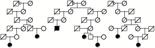 Example of a high-risk meningioma pedigree from UPDB showing a founder male (square) with descendants from 3 different female spouses (circles). Among the total of almost 9500 descendants of this male represented in UPDB (but not all shown), 7 meningioma cases (solid symbols) were observed and only 2.5 were expected (P = 0.01). Diagonal lines through symbols indicate the individual is deceased.