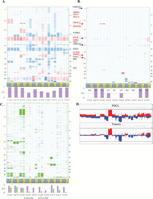Copy number variation landscape. (A). Tumor and PDCL heatmap. Tumors (T) and their paired PDCL (C) are adjacent to each other. Red denotes gain and blue denotes loss in relation to estimated ploidy. Darker color stands for higher gain or deeper deletion. The bar chart at the bottom gives the level of agreement for each tumor–PDCL pair. (B) Heatmap filtered for high-level amplification (CN≥ploidy+3) is denoted in red, and deeper deletions (CN=0 or CN≤1 if ploidy is 4) are colored blue. The bar chart at the bottom gives the level of agreement for each tumor–PDCL pair. (C) Heatmap describing estimated CN-LOH. The bar chart at the bottom gives the level of agreement for each tumor–PDCL pair with purple for general LOH and light green for CN-LOH. (D). Genomic landscape of the group of PDCLs (top) and group of tumors (bottom).