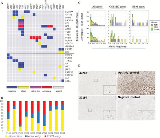 Point mutations landscape. (A) Point mutations for GBM driver genes (top) and druggable genes (bottom, below the red line). Tumors and their paired PDCL are adjacent to each other. Different colors are given for the mutation types. For the left 7 pairs, germ line information was used for somatic mutations inference. For the right 3 pairs, germ line information was unavailable and mutations defined as “novel” are shown (see “Methods” section). (B) Frequency of mutations that appeared in both tumor and PDCL (yellow), tumor only (blue), PDCL only (red). (C) Mutation characteristics for the combined set of somatic mutations. In each histogram, the distribution of allelic fraction (x-axis) of mutations is given. The y-axis denotes mutation count. Each histogram bar is divided for the tissues in which the mutations were detected: (i) both tumor and PDCLs, (ii) PDCL only, and (iii) tumor only. The 6 histograms are ordered in columns and rows. The columns define gene set groups: (i) all genes, (ii) COSMIC genes, (iii) GBM driver genes. The rows define the predicted functional impact class (“impact,” “no impact”). (D) TP53 staining for parental tumors 4724T and 3719T.