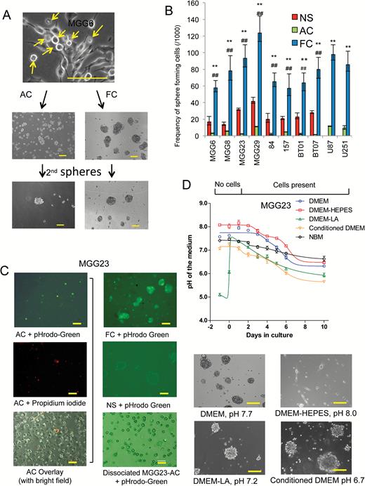 Isolation of a floating cell population from differentiated GBM cells. (A) Bright field micrographs of GSCs cultured in DMEM-FBS. A large proportion of floating cells (FC) emerge from adherent cell (AC) cultures. FC and AC were then cultured in NBM and only FC can form spheres and secondary spheres. Arrow, FC population. (B) One thousand single cells of NS, AC, and FC from 8 different GSCs and 2 GBM cell lines were cultured. One week later, extreme limiting dilution analysis (ELDA) was applied with 12 replicates. Statistics for stem cell frequencies (with 95% CIs) in FC, AC, and the corresponding NS are shown. **P < .01 FC vs AC, ##P < 0.01 NS vs FC. (C) Left panels: MGG23 cultured in DMEM-FBS and analyzed by fluorescence microscopy; upper, green showing low intracellular pH in FC; middle, propidium iodide staining; bottom, overlay with bright field image. Right: fluorescence analysis of MGG23 cells under different conditions; upper, MGG23 FC; middle, MGG23 NS; bottom, dissociated MGG23 AC. (D) Upper panel: pH in medium of MGG23 GSCs cultured in DMEM-FBS, DMEM-FBS with 25 mM of HEPES, DMEM-FBS with 15 mM lactic acid, conditioned medium, or NBM. Lower panels: bright field micrographs of FC collected under different conditions and cultured in NBM. Scale bar, 50 μm.