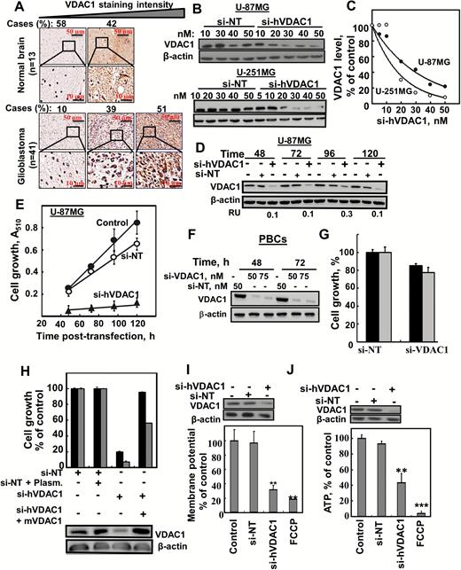 si-hVADC1 inhibited cell growth and reduced energy production in GBM cell lines. (A) IHC staining of VDAC1 of human normal brain (n = 13) or GBM (n = 41) in tissue microarray slides (Biomax). Percentages of sections stained at the intensity indicated are shown. (B, C) U-87MG and U-251MG cells were treated for 48 h with si-NT or si-hVDAC1 and analyzed for VDAC1 levels by immunoblotting. (D, E) U-87MG cells were treated with si-NT or si-hVDAC1 (50 nM) and at the indicated time were analyzed for VDAC1 levels (D) or for cell growth using a sulforhodamine B assay (E). (F, G) Mouse primary brain cells (PBCs) were incubated (48 and 72h) with si-NT or si-VDAC1(M/H) and analysed for VDAC1 levels (F) and cell growth (G) (n = 3). (H) U-87MG (black bars) and U-251MG (gray bars) cells were treated with si-NT or si-hVDAC1, transfected 24 h later with pcDNA4/TO, either empty or encoding mVDAC1, and 2 h later, cell growth was analyzed (n = 3). Δ
Ψ (I) and ATP (J) levels were analyzed in U-87MG cells (n = 3). FCCP (carbonyl cyanide-4-(trifluoromethoxy)phenylhydrazone), **P ≤ .01; ***P ≤ .001 (25 μM) served as control for decreasing Δ
Ψ and ATP levels. RU = relative unit.