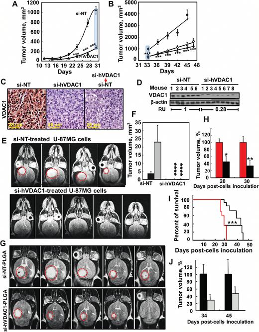 si-hVADC1 inhibition of tumor growth in vivo. (A) U-87MG cells were s.c. inoculated into nude mice. On day 13, the mice were divided into 2 groups and xenografts were injected every 3 days with si-NT (●, 8 mice) or si-hVDAC1 (▲, 16 mice) to a final concentration of 50–60nM (***P≤ .0001). (B) On day 33, the si-hVDAC-treated mice were subdivided into 2 groups (8 mice each). One group (▲) continued si-hVDAC1 treatment, the other switched to si-NT (○) treatment. si-NT-TTs and si-hVDAC1-TTs sections stained for VDAC1 by IHC (C) or immunoblot (D). RU = average relative units. (E) Orthotopic GBM, MRI of brains 33 days post-engraftment with U-87MG cells treated with si-NT or si-VDAC1. (F) Calculated tumor volume after 22 (black bars) and 33 days (gray bars). Results = mean ± SEM (n = 4–5), ****P ≤ .0001. (G) MRI of brains engrafted with U-87MG cells, 22 days after cell engraftment and treatment start. Two days post-engraftment, the mice were divided into 2 groups (6 mice each) and injected i.v. every 3 days with 100 μL of si-NT- or si-hVDAC-encapsulated-PLGA nanoparticles (400 nM siRNA). (H) Calculated tumor volume after 20 and 30 days. Red and black bars representing tumor volume of mice treated with si-NT- or si-hVDAC-encapsulated PLGA nanoparticles, respectively. Results = mean ± SEM (n = 6), *P ≤ .05; **P ≤ .01. (I) Mice survival over time of si-NT-PLGA- (red line) and si-hVDAC1-PLGA nanoparticle (black line) treated mice is presented in the cumulative Kaplan–Meier survival curves. ***P ≤ .001. (J) Orthotopic MZ-18 cells (10 × 104) (PDX) were engrafted into mice brains and 2 days later, the mice were divided into 2 groups (6 mice each) and injected i.v. every 3 days with si-NT- (black bars) or si-hVDAC (gray bars)-encapsulated PLGA-PEI nanoparticles (400 nM siRNA). Tumor volume was calculated from MRI taken 34 days post cell engraftment, and then 10 days after treatment termination (day 45).