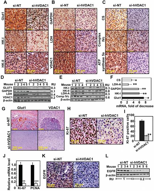 Reversal of the U-87MG tumor cell reprogrammed metabolism by si-hVDAC1 treatment. (A–C) IHC of s.c. si-NT-TTs or si-hVDAC1-TTs stained for the indicated antibodies. (D, E) Immunoblot of selected proteins. RU = relative unit. (F) Levels of mRNA of metabolic enzymes in si-hVDAC1-TTs relative to those in si-NT-TTs. Results = mean ± SEM (n = 3–5), *P ≤ .05; **P ≤ .01. (G) Representative IHC sections from brains engrafted with si-NT- or si-hVDAC1–treated U-87MG cells, 22 days after cell grafting, stained for Glut1 and VDAC1. (H, I) IHC of s.c. si-NT-TTs and si-hVDAC1-TTs stained for Ki-67; positive cells were counted over several fields. (J) Analysis by qRT-PCR of Ki-67 and proliferating cell nuclear antigen (PCNA) mRNA levels in si-NT- (black bars) and si-hVDAC1 (gray bars)-TTs. Results = mean ± SEM (n = 3–5), **P ≤ .01; ***P ≤ .001). (K, L) IHC and immunoblot analyses of epidermal growth factor receptor.
