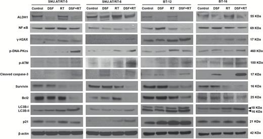 Radiosensitizing mechanisms of DSF. The expression of ALDH1, NF-κB, γ-H2AX, p-DNA-PKcs, p-ATM, cleaved caspase-3, Survivin, Bcl2, LC3B-I and -II, and p21 was analyzed in SNU.AT/RT-5, SNU.AT/RT-6, BT-12, and BT-16 cells by western blotting.
