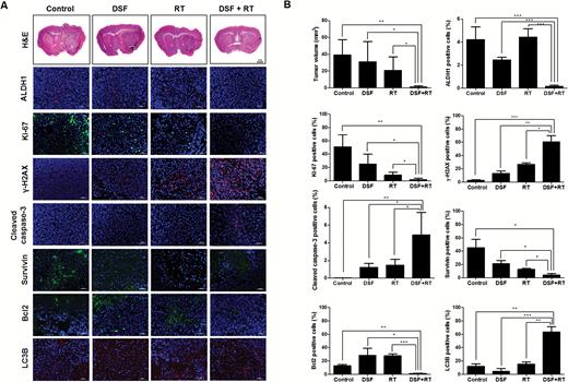 In vivo radiosensitizing effects of DSF. Mice transplanted with AT/RT cells were randomly grouped into the control, DSF, RT, or DSF + RT group. (A) Hematoxylin and eosin (H&E) staining and immunofluorescence against ALDH1, Ki-67, γ-H2AX, cleaved caspase-3, Survivin, Bcl2, and LC3B were performed at day 56. Magnification for H&E, ×1.25. The outlines indicate tumor margins. Scale bar for immunofluorescence, 50 µm. Nuclei were counterstained with 4′,6′-diamidino-2-phenylindole (blue). (B) The tumor volume and positive cell number for ALDH1, Ki-67, γ-H2AX, cleaved caspase-3, Survivin, Bcl2, and LC3B were quantified and compared (n = 3 for each group). *P < .05, **P < .01, ***P < .001.