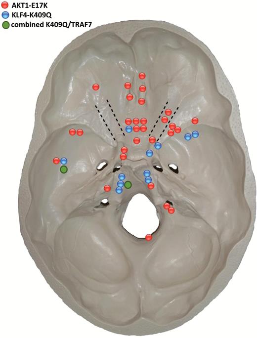 Distribution of AKT1E17K (red dots), KLF4 (blue dots), and combined KLF4/TRAF7 mutations (green dots) at the skull base.