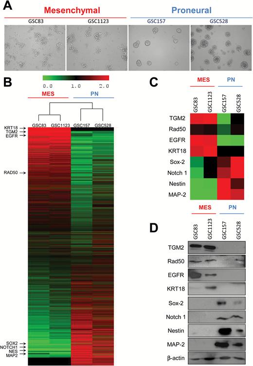 Phenotypic and molecular heterogeneity of glioma stem cells (GSCs). (A) Morphology of mesenchymal (MES) and proneural (PN) GSCs in sphere culture—phase contrast microscopy, under 10x objective. (B) Proteomes of MES and PN cell lines. The main validated subtype-specific proteins are indicated (arrows). (C) Differentially expressed proteins extracted from the proteome of MES and PN GSCs. (D) Western blot validation of differentially expressed marker proteins in MES and PN GSC lines.