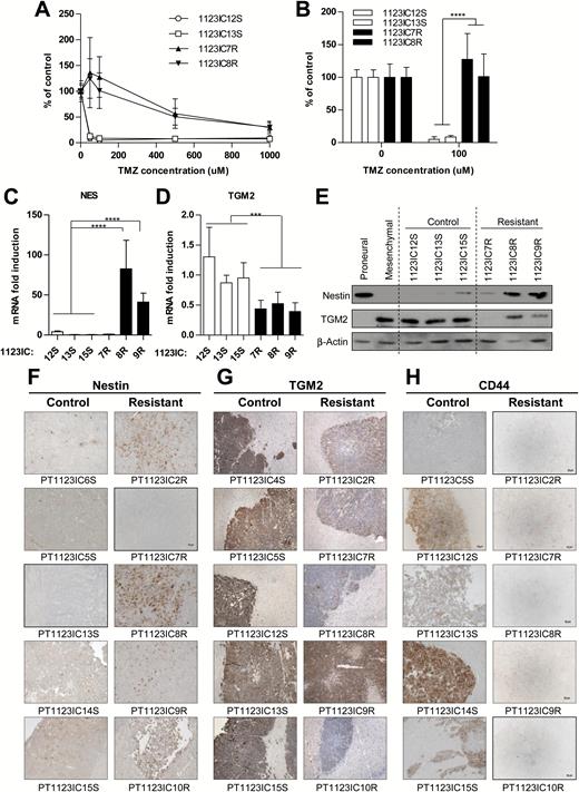 Secondary GSCs represent a stable and cell intrinsic TMZ resistance phenotype, coupled with a loss of mesenchymal characteristics. (A, B) TMZ resistance of GSCs is maintained in sphere culture (MTS viability assay, see text). MTS assay after TMZ treatment in 2 SGSC lines (1123IC8R, 1123IC7R) from TMZ-unresponsive tumors and 2 SGSC lines from control tumors (1123IC12S, 1123IC13S) (N = 3; 100% = no TMZ). ****P < 0.0001. (C–E) TGM2 downregulation and Nestin induction in TMZ resistant phenotype were observed in vitro after isolation of SGSCs from xenograft tumors, at the mRNA level tested by qPCR (C, D) (1 = average mRNA expression in TMZ-sensitive cell lines), and at the protein level by western blot (E). ****P < 0.0001; **P < 0.01 (N = 3). (F–H) Immunostaining of mesenchymal control (PT1123ICxS) and TMZ-treated (PT1123ICxR) intracranial tumors confirmed the variability in protein expression, a trend toward a decrease in mesenchymal markers TGM2 and CD44, and an upregulation of Nestin expression after acquisition of resistance to TMZ (objective 20x).