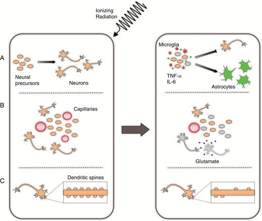 Selected proposed mechanisms of radiation-induced neurocognitive dysfunction. (A) Pro-inflammatory changes following radiotherapy result in an increase in the numbers of microglia which produce TNF-α and IL-6. This contributes to an ongoing inflammatory state and alteration in the microenvironment, which preferentially drive differentiation of neural precursors to an astrocytic lineage. (B) Radiation disrupts the vascular niche of the neural precursors and additionally leads to ischemia and toxic neuroexcitation among mature neurons. (C) Radiation exposure reduces the number of dendritic spines on mature neurons, which in turn disrupts synaptic efficiency.