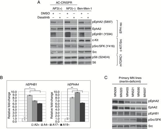 Expression and activation of EPH RTKs, Src/SFK, and c-KIT in NF2-null AC and MN cells. (A) NF2-null ACs and Ben-Men-1 show increased pEPHA2(S897), pEPHB1(Y594), pSrc/SFK(Y416), c-KIT, and mTORC1 signaling (readouts: pS6K/pS6) compared with NF2(+) ACs. Dasatinib (100 nM, 2 h) inhibits pEPHA2, pEPHB1, and pSFK with no effects on mTORC1 and c-KIT. (B) All NF2− AC-CRISPR lines (A4, A17, A19) show increased transcription of EPHB1 and EPHA4 by quantitative RT-PCR compared with NF2+ A2. *P < 0.06; **P < 0.005. (C) NF2-deficient primary MN lines show heterogeneous activation.