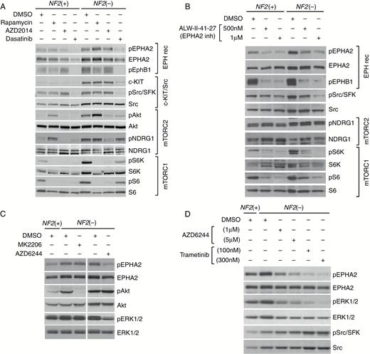 Independent activation of the mTOR and EPH receptor pathways in NF2-null ACs and inhibition of EPHA2(S897) phosphorylation by MEK inhibitors. (A) AC-CRISPR lines (NF2+ and NF2−) treated for 24 h with rapamycin (20 nM) or AZD2014 (300 nM) show inhibition of mTORC1 (readouts: pS6K/pS6) and mTORC2 (readouts: pAkt/pNDRG1) signaling with no effect on EPHA2, EPHB1, c-KIT, or Src/SFK. Dasatinib (100 nM, 24 h) attenuates pEPHA2, pEPHB1, c-KIT, and pSrc/SFK with modest effects on mTORC1/2 signaling. (B) EPHA2 inhibitor ALW-II-41-27 (24 h) blocks pEPHA2, pEPHB1, and pSrc/SFK with no effect on mTORC2 signaling, while attenuating mTORC1 signaling. (C) Treatment of NF2− ACs with AZD6244 (1 µM, 2 h) inhibits pEPHA2(S897), while MK2206 (1 µM) did not. (D) Treatment of NF2− ACs for 24 h with AZD6244 or trametinib inhibits pEPHA2(S897) and pERK1/2 while increasing phospho- and total Src/SFK.