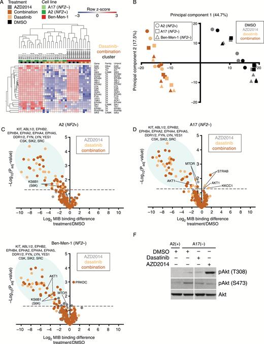 Combined AZD2014/dasatinib treatment elicits target inhibition in NF2-null lines. (A) Indicated cell lines were treated 24 h with DMSO, AZD2014, dasatinib, or AZD2014/dasatinib (Combination) followed by MIB/MS. LFQ intensities were log2 transformed and quantile normalized, and hierarchical clustering was performed. Values were mean-centered, and row z-score color key is shown. Strongly responsive “Dasatinib-Combination” cluster is shown. Cell lines and treatments are identified by color key. (B) Principal components analysis of LFQ intensities as in (A). Cell line is indicated by shape and treatment by color. (C–E) Volcano plots show log2 fold-change for each treatment (color-coded) versus DMSO plotted against the −10g10 Padj value. Dotted lines P = 0.05. (F) Immunoblotting shows induction of pAkt(T308) in NF2-null ACs after 24 h AZD2014 treatment.