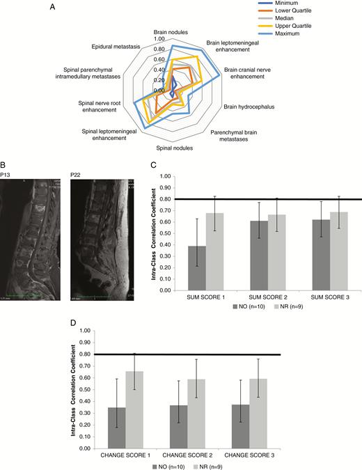 Neuroradiological assessment of LM using the LANO scorecard. (A) Median, range, and quartiles for interrater variability of single RANO items upon assessment of newly diagnosed LM at baseline assessment. (B) Representative sagittal spinal contrast-enhanced, T1-weighted MRI from P13 and P22, rated as showing nodules by a majority of raters. (C, D) Overall concordance rates for neuro-oncologists (NO) versus neuroradiologists (NR) for the sum scores (C) and the change scores (D) (for details see Tables 2 and 4).
