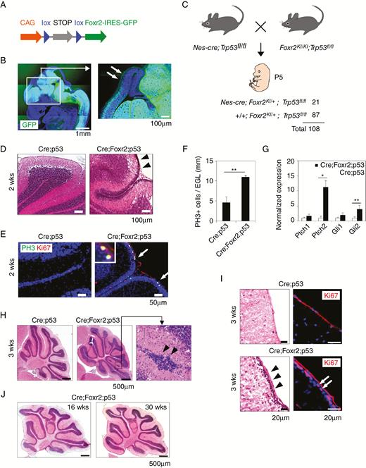 Foxr2 overexpression promoted GNP proliferation in the cerebellum. (A) Schematic of the construct. (B) GFP expression in the developing brain of Nes-cre;Foxr2KI mice at E13. Arrows, developing cortex. Bars, 1 mm and 100 µm. (C) Mating strategy and genotypic analysis of pups at P5. (D) H&E staining of the cerebellum in Nes-cre;Trp53fl/fl (Cre;p53) and Nes-cre;Foxr2KI;Trp53fl/fl (Cre;Foxr2;p53) mice at 2 weeks (2w). Arrowheads, EGL. Bars, 100 µm. (E) Expression of PH3 and Ki67 in the cerebellum of Cre;p53 and Cre;Foxr2;p53 mice at 2w. Bars, 50 µm. (F) Average number of PH3+ cells in the cerebellum of Cre;p53 and Cre;Foxr2;p53 mice (2w). Data represent mean ± SEM (n = 4 per group). (G) Expression levels of SHH target genes in the cerebellum of Cre;p53 and Cre;Foxr2;p53 mice (2w). Expression levels were normalized by SDHA. Data represent mean ± SEM (n = 3 per group). Student’s t-test (2-tail), *P < 0.05, **P < 0.01. (H) H&E staining of the cerebellum in Cre;p53 and Cre;Foxr2;p53 mice (3w). Arrowheads point to abnormal cluster of granule neurons. Bars, 500 µm. (I) Presence of the EGL in Cre;Foxr2;p53 mice at 3w (arrowheads). Arrows, Ki67+ proliferating. Bars, 20 µm. (J) H&E staining of the cerebellum of Cre;Foxr2;p53 mice at 16w and 30w. Bars, 500 µm.
