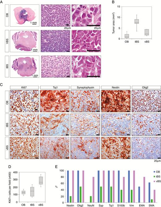 Brain tumors showed histological features of CNS-embryonal tumor. (A) H&E staining of tumors in the OB and BS. Bars, 1 mm and 20 µm. (B) Box and whisker plot of tumor area in the OB (n = 8), tBS (n = 10) and vBS (n = 5). (C) Representative images of tumor sections stained with antibodies against Ki67, Tuj1, synaptophysin, Nestin, and Olig2. Bars, 20 µm. (D) Number of Ki67+ cells per field (x400) in the OB (n = 8), tBS (n = 10), and vBS (n = 5). (E) Percentage of tumors in the OB (n = 8), tBS (n = 10), and vBS (n = 5) that showed immunoreactivity against different markers.