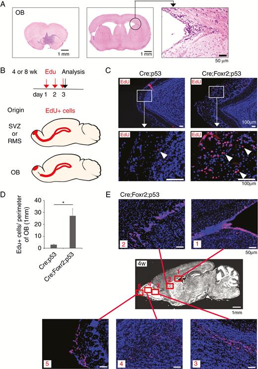 Expansion of Olig2+ cells in the OB. (A) SVZ architecture was preserved in the mouse with OB tumor. Bars, 1 mm and 50 µm. (B) Experimental design is shown. Depending on the cell-of-origin for OB tumors, EdU+ cells are expected to show different distribution patterns. (C) EdU+ cells in the outer part of the OB in Cre;p53 and Cre;Foxr2;p53 mice at 4w. Regions in white boxes are shown in the magnified view. Arrowheads, EdU+ cells. Bars, 100 µm. (D) Total number of EdU+ cells in the outer part of the OB was divided by the perimeter of the OB. Student’s t-test (2-tailed, n = 4 per group). *P < 0.05. (E) EdU-incorporated cells were visualized in the SVZ, RMS, and OB of the brain of Cre;Foxr2;p53 mice at 4w. Bars, 1 mm and 50 µm.