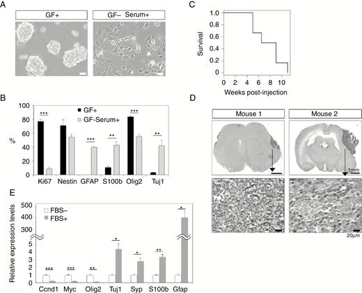 Isolation of tumor-initiating cells from CNS-embryonal tumor. (A) Tumor-derived spheres (left). Removal of growth factors (GFs) and the addition of serum induced morphological changes on day 7 (right). Bars, 50 µm. (B) Percentage of the cells that expressed markers was calculated by immunohistochemistry. Data represent means ± SEM (n = 3). (C) Kaplan–Meier plot shows survival of mice transplanted with tumor cells (n = 6 per group). (D) Tumor formation in the brain after intracranial transplantation of sphere-forming cells. Tumors in 2 animals are shown. Bars, 1 mm and 20 µm. (E) Gene expression analysis was performed using tumor-initiating cells cultured in the absence of serum or after the addition of serum. Data represent means ± SEM (n = 3). Expression levels were normalized relative to SDHA. *P < 0.05, **P < 0.01, ***P < 0.001, Student’s t-test (2-tail).