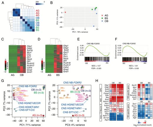 Gene expression analysis of tumor-initiating cells for CNS-embryonal tumors. (A) Heatmap of sample distance matrix showing similarities between samples. High similarities are shown in dark blue. (B) The PCA plot shows the variation among OB tumor cells (n = 3), BS tumor cells (n = 3), and astroglia (AG) (n = 3). (C, D) Heatmap with hierarchical clustering distances shows the variation in the expression levels (z-score) of the genes that were upregulated in OB (C) and BS (D) tumor cells compared with astroglia (adj. P-value < 0.01, log2(FC) > 2). Upregulated were 1258 and 1176 genes in OB and BS tumor cells, respectively (Supplementary Tables 5 and 6). Representative genes are shown. (E, F) Gene set enrichment analysis was performed for gene expression in OB and BS tumor cells compared with AG using the top 500 genes upregulated in CNS NB-Foxr2 compared with high-grade gliomas (HGGs) (Supplementary Table 8).8 (G) The PCA plot shows the variation among OB tumor cells, BS tumor cells, AG, the 4 subtypes of CNS-embryonal tumors, MBs, and HGGs.8 (H) Heatmap of expression levels of representative genes in OB and BS tumor cells.