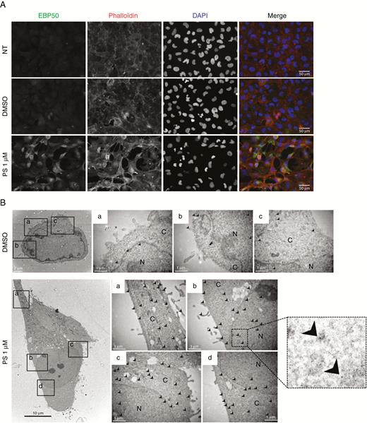 EBP50 immunocytochemistry and immunogold labeling. NEM157-i cells were treated with DMSO or PS during 24 hours before fixation. (A) Immunofluorescence with EBP50 antibody (green), phalloïdin (red), and nuclei (blue) staining. Objective x40. (B) Immunogold electron microscopy localization of EBP50 proteins. Arrows indicate the localization of EBP50 detected by 10 nm gold particles in different cellular compartments. Box on the right represents a zoom to visualize gold particles. N: nuclei, C: cytoplasm. Scale bars are indicated on pictures.