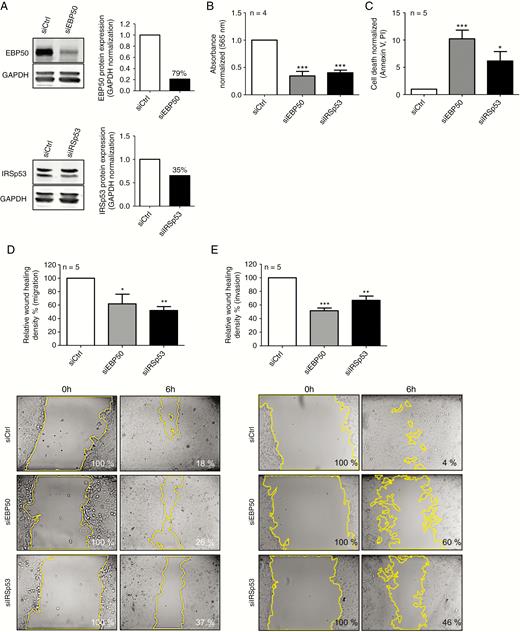Biological effects of EBP50 and IRSp53 downregulation by siRNAs (NEM157-i line). (A) Western blot validation of downregulation by siRNAs. Percent downregulation is indicated on graphs. (B) Cell proliferation assays 96 hours after transfection measured by sulforhodamine B assay. (C) Cell death was measured by FACS with annexinV–fluorescein isothiocyanate/PI staining 72 hours after transfection. (D) Migration 48 hours after transfection was measured using wound healing assay. Cells were incubated 6 hours after injury. (E) Invasion was measured 48 hours after transfection by wound healing assay coated with Matrigel. Cells were incubated 48 hours after injury. Representative photos of one experiment used for quantification are shown. All graphs were normalized to siCtrl.