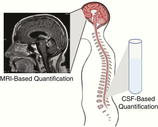 Proposed methods of quantification of burden of disease in patients with LM. Radiographic assessment, CTC quantification, and cfDNA concentration can be used as quantitative measures of disease burden at the time of LM diagnosis. Increasing burden of disease (more radiographic sites of disease, elevated CTCs, and higher CSF cfDNA concentration) are associated with shorter survival times in patients with LC-LM.