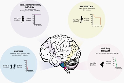 Schema illustrating some of the different entities among brainstem gliomas, clinical characteristics, most frequent alterations, and overall survival outcomes.