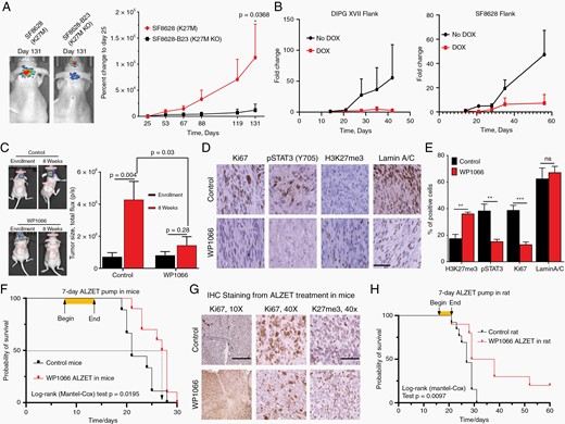 STAT3 inhibition results in tumor stasis or regression of patient-derived H3K27M-mutant DMG xenografts. (A) Bioluminescent imaging of H3K27M-KO and H3K27M-mutant SF8628 intracranial xenografts. (B) Tumor growth of patient-derived flank H3K27M-mutant xenografts as assessed by bioluminescent imaging in animals with or without doxycycline treatment. (C) Bioluminescent imaging of PED17 (H3K27M-mutant) orthotopic xenografts in mice treated with WP1066 or vehicle. Vehicle-treated mice are shown on the left, WP1066-treated mice on the right. (D, E) Relative expression of Ki67, pSTAT3 (Y705), and H3K27me3 in formalin-fixed brain sections of mice treated with WP1066 or vehicle (40×, scale bar = 100 µm). (F) Kaplan–Meier curve of ALZET-vehicle or -WP1066-treated DIPGXIII orthotopic xenografts in mice. (G) Representative immunohistochemical stains for Ki67 and H3K27me3 in formalin-fixed specimens obtained from animals in the study shown in panel F (10×, scale bar = 400 µm; 40×, scale bar = 100 µm). (H) Kaplan–Meier curve of ALZET-vehicle or -WP1066-treated DIPGXIIIp orthotopic xenografts in rats.