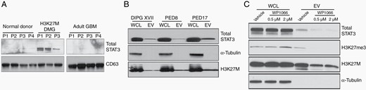 STAT3 is present in plasma extracellular vesicles (EVs) of patients with H3K27M-mutant DMG. Western blots demonstrating total STAT3 expression in (A) H3K27M-mutant DMG patients compared to normal controls and adult glioblastoma, (B) patient-derived cell line EVs obtained from culture media, and (C) in culture media of DIPGXVII cells treated with the STAT3 inhibitor WP1066 versus vehicle.