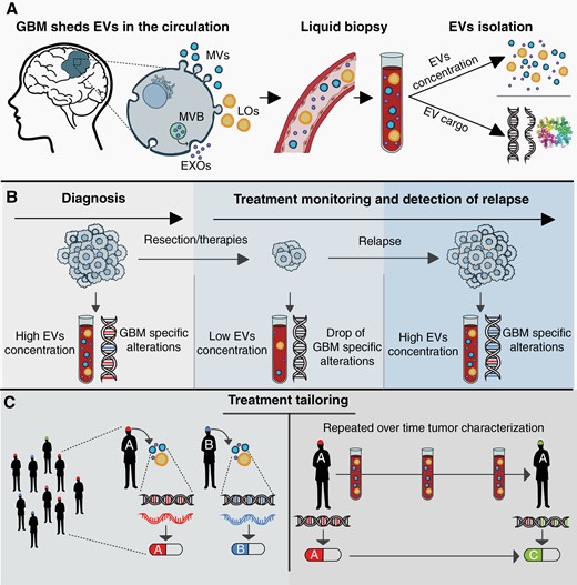 EVs: the key for precision medicine in GBM. (A) GBM-associated EVs (EXOs in purple, MVs in blue, and LOs in yellow) can be isolated from peripheral blood and used as a platform for liquid biopsy. EVs possess multilayered information constituted by their concentration and molecular cargo, spanning DNA and RNA to proteins and lipids. (B) The concentration and cargo of EVs indicate GBM presence allowing diagnosis, monitoring of tumor response to therapy, and identifying relapse. (C) An EV-based liquid biopsy approach may enable the characterization of the whole-GBM molecular set-up. Tumor characterization at baseline would allow treatment personalization (left panel), and serially, during treatment, it would allow treatment tailoring, thus maximizing its efficacy and tackling GBM molecular dynamicity (right panel).