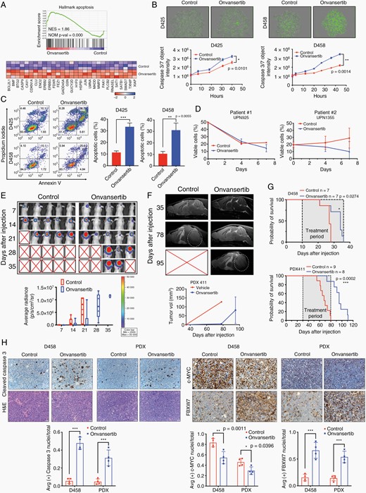 Onvansertib increases apoptosis and attenuates tumor growth in vivo. (A) GSEA of apoptosis pathway. (B) Real-time detection of apoptosis in Incucyte Nuclight Green labeled MB cells treated with DMSO or onvansertib. Apoptotic cells are quantified using the caspase 3/7 Incucyte Live-Cell Analysis System. (C) Annexin V apoptosis analysis of MB cells. (D) Cell viable analysis in short term cultured primary cancer cells from two patients. (E) Representative images of bioluminescence imaging after injection were shown. (F) Representative MRI in PDX xenografts mice. White circles indicate tumor. (G) Kaplan–Meier survival curve of mice treated with vehicle or onvansertib. (H) Representative immunohistochemistry staining for H&E, cleaved caspase 3, c-MYC, and FBXW7. Images taken at 40× magnification.