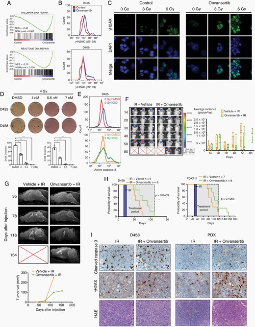 Onvansertib enhances radiation sensitivity of medulloblastoma. (A) GSEA of DNA repair gene sets. (B) Flow cytometry analysis of P-γH2AX (pS139) in MB cells. (C) Immunofluorescence of P-γH2AX (green) and DAPI (blue) at 40×. D425 cells were treated with onvansertib for 48 h and then exposed to 0 Gy, 3 Gy, or 6 Gy radiation. (D) Methylcellulose assay in MB cells treated with 4 Gy radiation in combination with onvansertib treatment. (E) Flow cytometry analysis of apoptotic population measured by cleaved caspase 3. D425 cells were treated with onvansertib for 48 h and then exposed to 0 Gy or 6 Gy radiation. (F) Nude mice xenograft injected with D458 cells were treated with radiation alone or radiation with onvansertib. Representative images of bioluminescence imaging after injection were shown. (G) Representative MRI in PDX mice. White circles indicate tumor. (H) Kaplan–Meier survival curve of xenografts models. (I) IHC analyses of cleaved caspase 3 and P-γH2AX protein expression in xenografts mice. Original magnification, ×40.