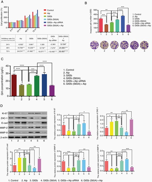 Effect of GTF2B on tumor cell phenotype of GH3 cell line. A. Proliferation analysis of tumor cell with different transfection by MTT assay. OD value of control group at 0 h was normalized as 100% and all relative cell proliferation value at different time points are shown in column diagram above; the table below displays the relative inhibitory rate vs. control group at each time point. B. Transwell array was used to assess GH3 cell invasiveness with various treatments (original magnification, ×200). C. ELISA was performed to test GH secretion of GH3 cell with various treatments. D. Western blot analysis of Ki-67, ZAC-1, E-cadherin, MMP2 and MMP9 expression in GH3 cell line with various treatments. Each condition was tested in triplicate. The two-tailed Student’s t-tests were used. Bar represents mean ± SD, *P < .05, **P < .01, ***P < .001, and ****P < .0001.
