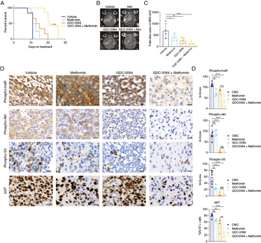 Metformin improves the efficacy of PI3K inhibition in an orthotopic GBM mouse model, (A) Mice bearing orthotopic 667 GBM xenografts were treated with GDC-0084 (15 mg/kg) and/or metformin (200 mg/kg), and overall survival was measured from the time of treatment initiation. (B) Mice underwent MR brain imaging at 8–10 days after treatment initiation, with results quantified in C. (D) Tumor tissue was harvested from mice at the survival endpoint and processed for immunohistochemistry with the indicated antibodies. Percent expression and H-scores were quantified using Halo software (E). Met, metformin. *P < .05, **P < .01, ***P < .001, ****P < .0001. Scale bars = 20 μm. GBM, Glioblastoma.