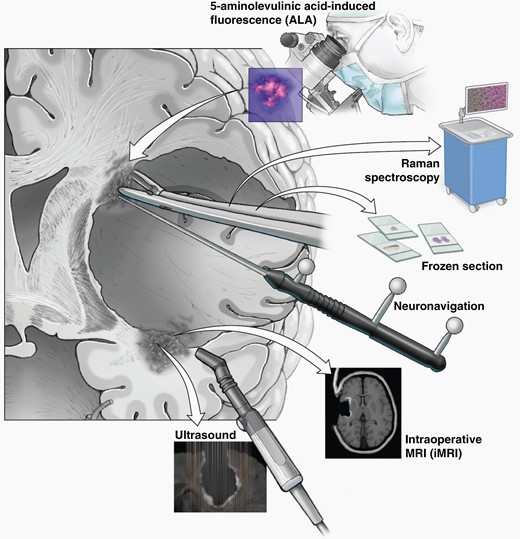 Methods for identification of tumor margins intraoperatively.